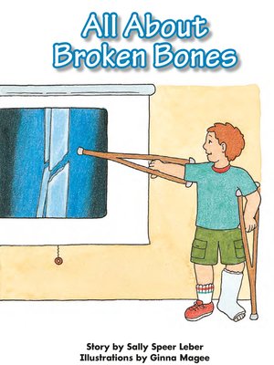 cover image of All About Broken Bones